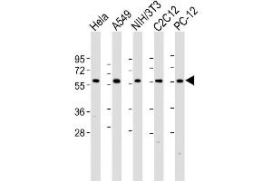 Image no. 5 for anti-Pyruvate Kinase M2 (PKM2) (AA 476-505), (C-Term) antibody (ABIN391053)