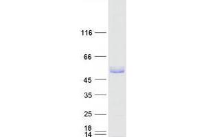 Image no. 1 for Tripartite Motif Containing 15 (TRIM15) protein (Myc-DYKDDDDK Tag) (ABIN2734225)