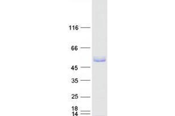 Tripartite Motif Containing 15 (TRIM15) protein (Myc-DYKDDDDK Tag)