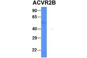 Image no. 2 for anti-Activin A Receptor, Type IIB (ACVR2B) (Middle Region) antibody (ABIN2782110)