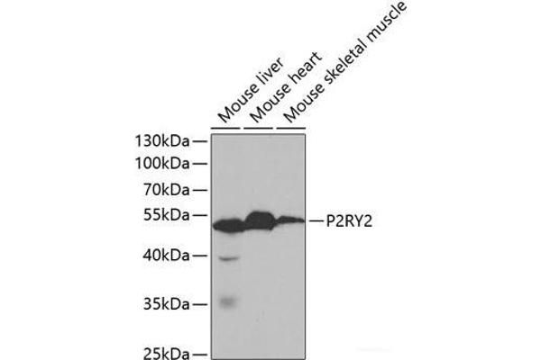 P2RY2 anticorps