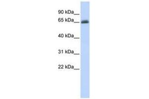 Image no. 1 for anti-UDP Glucuronosyltransferase 2 Family, Polypeptide B15 (UGT2B15) (AA 72-121) antibody (ABIN6740741)