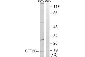 Image no. 2 for anti-Vesicle Transport Protein SFT2B (SFT2B) (Internal Region) antibody (ABIN1852378)