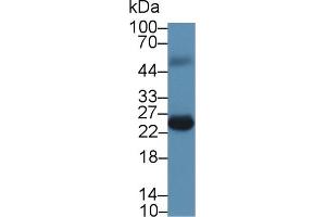 Detection of FKBP7 in Mouse Heart lysate using Monoclonal Antibody to FK506 Binding Protein 7 (FKBP7)