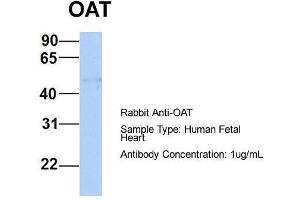 Image no. 3 for anti-Ornithine Aminotransferase (OAT) (Middle Region) antibody (ABIN2783233)