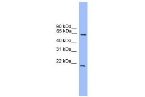 Image no. 1 for anti-Dachshund 1 (DACH1) (C-Term) antibody (ABIN2778444)