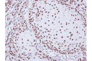 Image no. 2 for anti-Squamous Cell Carcinoma Antigen Recognized By T Cells (SART1) (Internal Region) antibody (ABIN2855616)