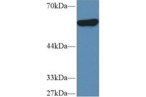 PKM2 anticorps  (AA 141-248)