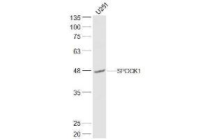 Image no. 1 for anti-Sparc/osteonectin, Cwcv and Kazal-Like Domains Proteoglycan (Testican) 1 (SPOCK1) (AA 51-150) antibody (ABIN1386636)