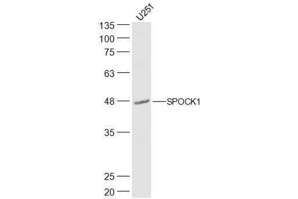 anti-Sparc/osteonectin, Cwcv and Kazal-Like Domains Proteoglycan (Testican) 1 (SPOCK1) (AA 51-150) antibody