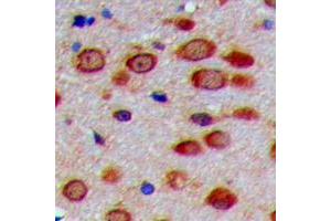 Image no. 1 for anti-Peroxisome Biogenesis Factor 11 gamma (PEX11G) (N-Term) antibody (ABIN2707696)