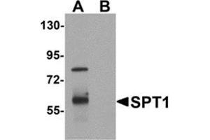 Image no. 1 for anti-Vasohibin 1 (VASH1) (C-Term) antibody (ABIN783478)