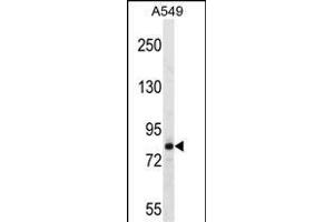 FSCB 抗体  (C-Term)