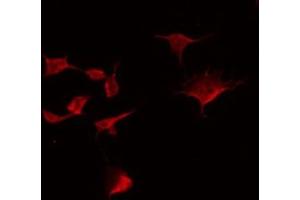 Image no. 2 for anti-Fibulin 5 (FBLN5) antibody (ABIN6257193)