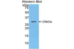Image no. 1 for anti-Fibroblast Growth Factor Receptor 2 (FGFR2) (AA 157-377) antibody (ABIN1858879)