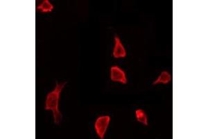 Image no. 1 for anti-Cortactin (CTTN) (pTyr466) antibody (ABIN6256746)