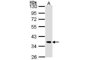 Image no. 1 for anti-F-Box and Leucine-Rich Repeat Protein 12 (FBXL12) (C-Term) antibody (ABIN2855977)