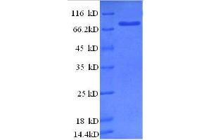 SDS-PAGE (SDS) image for Endonuclease, VIRD2 (VIRD2) (AA 1-447), (full length) protein (GST tag) (ABIN1047714)