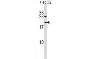 PPIAL4A antibody  (N-Term)