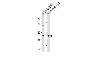 Image no. 1 for anti-Ankyrin Repeat and SOCS Box-Containing 11 (ASB11) (AA 26-54), (N-Term) antibody (ABIN1881072)