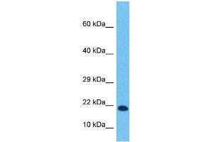 Image no. 7 for anti-Transcription Factor 21 (TCF21) (N-Term) antibody (ABIN2777930)