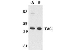 Image no. 2 for anti-Tumor Necrosis Factor Receptor Superfamily, Member 13B (TNFRSF13B) (N-Term) antibody (ABIN500863)