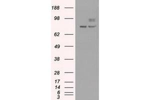 Image no. 14 for anti-Premelanosome Protein (PMEL) antibody (ABIN1500300)