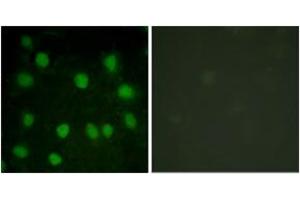 Image no. 3 for anti-erythrocyte Membrane Protein Band 4.9 (Dematin) (EPB49) (AA 356-405) antibody (ABIN1532596)