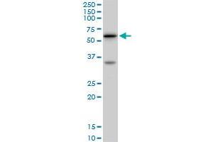 Image no. 4 for anti-V-Akt Murine Thymoma Viral Oncogene Homolog 1 (AKT1) (AA 1-480) antibody (ABIN559834)