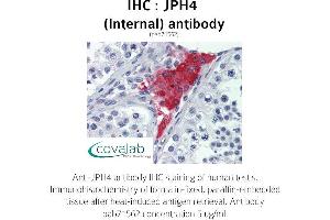 Image no. 2 for anti-Junctophilin 4 (JPH4) (Internal Region) antibody (ABIN1736134)