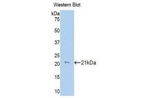 COL8a2 antibody  (AA 533-698)