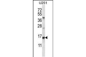 Image no. 3 for anti-Inhibitor of DNA Binding 1, Dominant Negative Helix-Loop-Helix Protein (ID1) (AA 66-93) antibody (ABIN5534403)