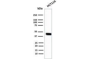 Image no. 1 for anti-Keratin 18 (KRT18) antibody (ABIN6939939)