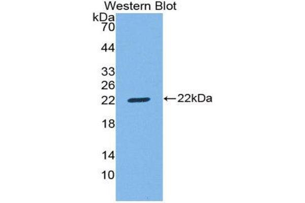 CD8B antibody  (AA 22-175)