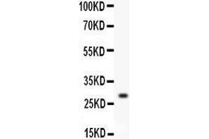 Image no. 2 for anti-Kallikrein 1 (KLK1) (AA 25-261) antibody (ABIN3042937)