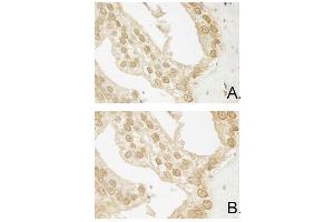 Image no. 4 for anti-V-Akt Murine Thymoma Viral Oncogene Homolog 3 (Protein Kinase B, Gamma) (AKT3) (Internal Region) antibody (ABIN1043749)