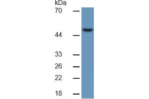 Image no. 5 for Matrix Metallopeptidase 13 (Collagenase 3) (MMP13) ELISA Kit (ABIN6730928)