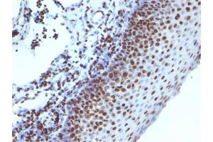 Histone H1 anticorps