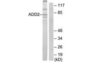 Image no. 1 for anti-Adducin 2 (Beta) (ADD2) (AA 471-520) antibody (ABIN1534258)