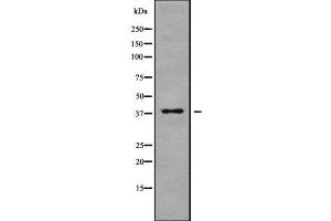 Image no. 1 for anti-Membrane-Associated Ring Finger (C3HC4) 9 (MARCH9) antibody (ABIN6263128)