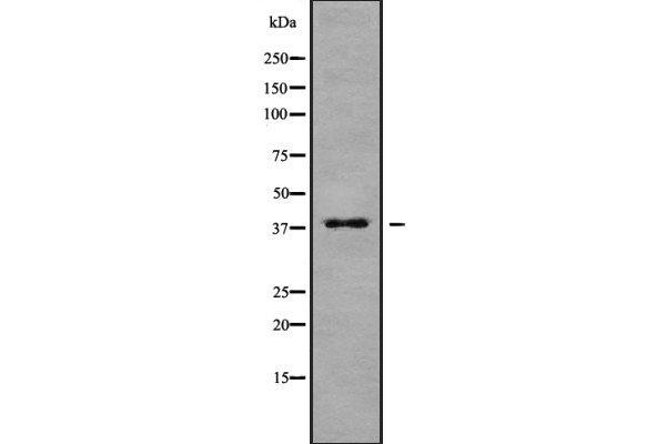 anti-Membrane-Associated Ring Finger (C3HC4) 9 (MARCH9) (N-Term) antibody