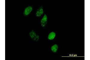 Immunofluorescence of purified MaxPab antibody to EAF1 on HeLa cell.