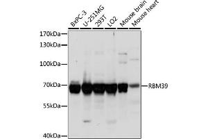 RBM39 抗体  (C-Term)