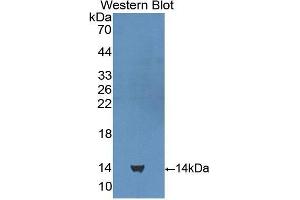 Image no. 1 for anti-Cubilin (Intrinsic Factor-Cobalamin Receptor) (CUBN) (AA 3511-3623) antibody (ABIN1858561)