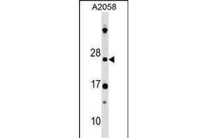 DR Antibody (N-term) 8211a western blot analysis in  cell line lysates (35 μg/lane).