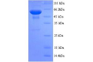 Image no. 1 for Spermine Oxidase (SMOX) (AA 1-555), (full length) protein (His tag) (ABIN5713848)