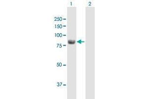 Image no. 1 for anti-Aldehyde Dehydrogenase 18 Family, Member A1 (ALDH18A1) (AA 1-795) antibody (ABIN1329146)
