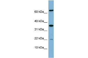 Image no. 2 for anti-RWD Domain Containing 1 (RWDD1) (Middle Region) antibody (ABIN2786930)