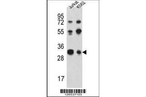 Image no. 1 for anti-TWIST Neighbor (TWISTNB) (AA 298-326), (C-Term) antibody (ABIN651453)
