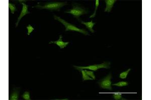Image no. 1 for anti-Mesencephalic Astrocyte-Derived Neurotrophic Factor (MANF) (AA 116-185) antibody (ABIN521690)